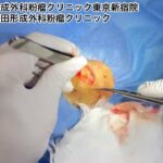 首の脂肪腫　ブログでも今回の脂肪腫について詳しく解説してます。ふるばやし形成外科粉瘤クリニック東京新宿院　大阪梅田形成外科クリニック